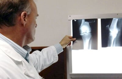 Dr. Roth Provides a Thorough X-ray Analysis for Every Patient