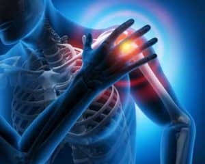 Shoulder Pain Treatment in Hot Springs AR at Health 1st Wellness & Physical Medicine